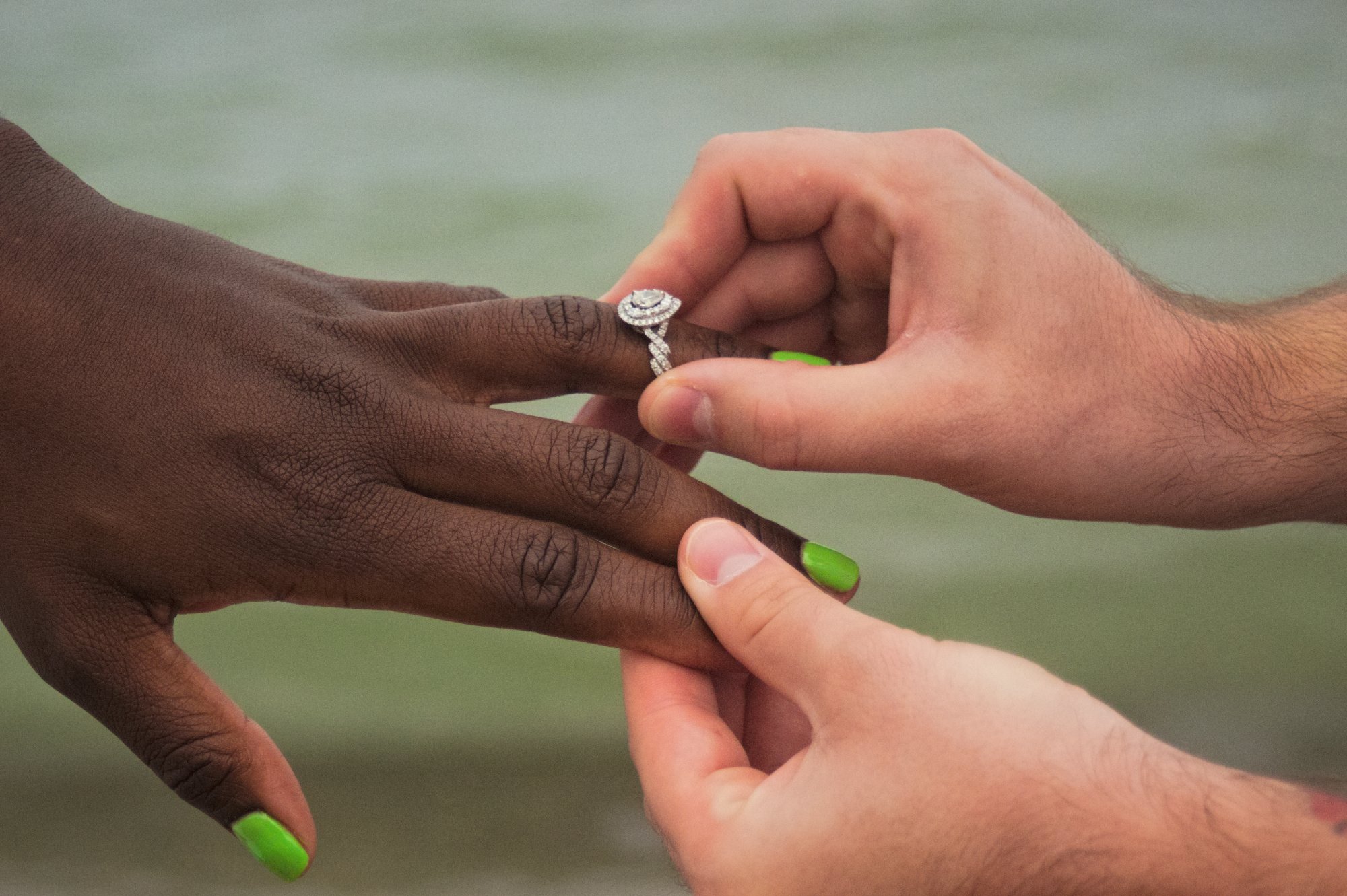 Ring placement beach